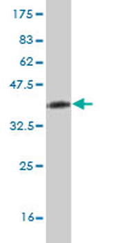 MYH9 monoclonal antibody (M03), clone 2B3