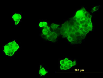 MYH9 monoclonal antibody (M01), clone 3C7