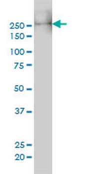 MYH9 monoclonal antibody (M01), clone 3C7