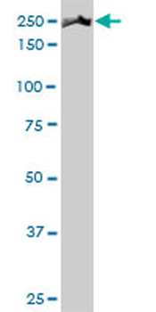 MYH9 monoclonal antibody (M01), clone 3C7
