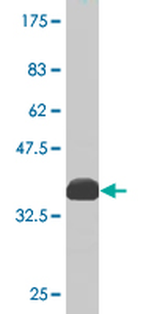 MYH9 monoclonal antibody (M01), clone 3C7