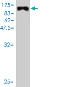 MYBPH monoclonal antibody (M01), clone 1F11