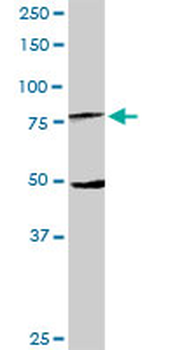 MX1 purified MaxPab rabbit polyclonal antibody (D01P)