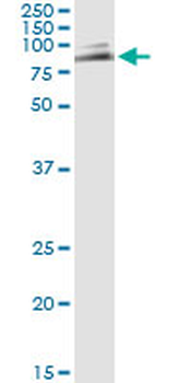MUTYH monoclonal antibody (M01), clone 4D10