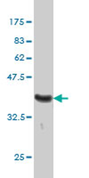 MUTYH monoclonal antibody (M01), clone 4D10
