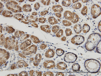 MUC4 monoclonal antibody (M07), clone 5B12