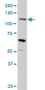 MUC4 monoclonal antibody (M07), clone 5B12