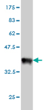 MUC4 monoclonal antibody (M07), clone 5B12