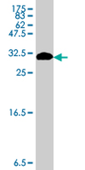 ND1 polyclonal antibody (A01)