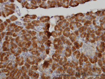 MTM1 monoclonal antibody (M01), clone 1C10