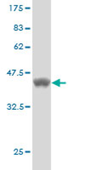 MTM1 monoclonal antibody (M01), clone 1C10