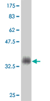 MSMB monoclonal antibody (M08), clone 3B11