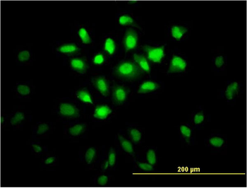 MSI1 monoclonal antibody (M04), clone 3F2