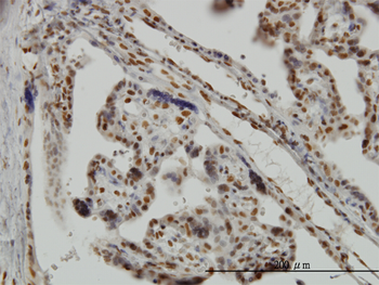 MSI1 monoclonal antibody (M04), clone 3F2