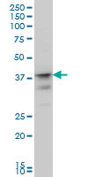 MSI1 monoclonal antibody (M04), clone 3F2
