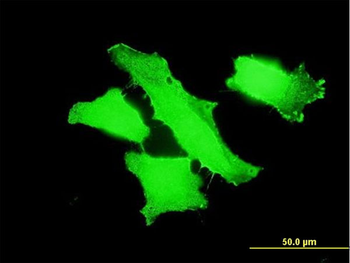 MPP1 monoclonal antibody (M01), clone 1E11-1G11