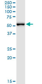 MPP1 monoclonal antibody (M01), clone 1E11-1G11