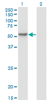 MPP1 monoclonal antibody (M01), clone 1E11-1G11