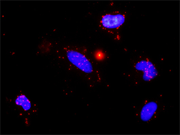 MMP9 monoclonal antibody (M03), clone 2H4