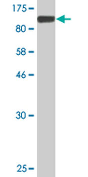 MMP9 monoclonal antibody (M03), clone 2H4