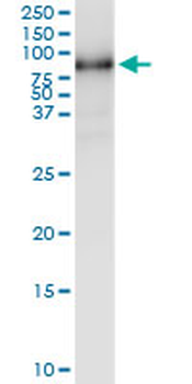 MMP1 MaxPab rabbit polyclonal antibody (D01)