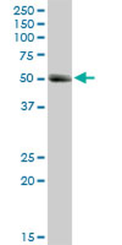 MMP1 MaxPab rabbit polyclonal antibody (D01)