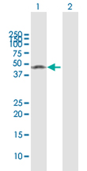 MMP1 MaxPab rabbit polyclonal antibody (D01)