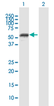 MMP1 purified MaxPab mouse polyclonal antibody (B01P)