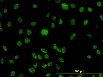 MLH1 monoclonal antibody (M02), clone M1