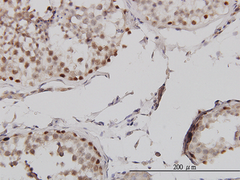 MLH1 monoclonal antibody (M02), clone M1