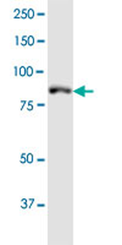 MLH1 monoclonal antibody (M02), clone M1