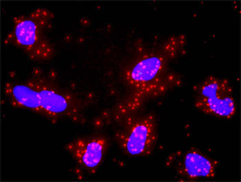MLH1 monoclonal antibody (M02), clone M1