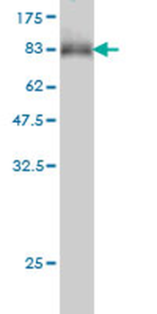MLH1 monoclonal antibody (M02), clone M1
