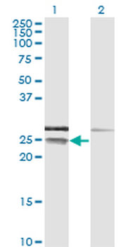 CD99 monoclonal antibody (M01), clone 3A10