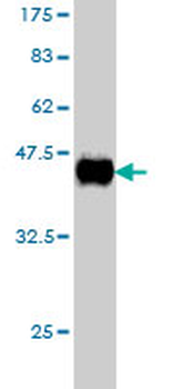 CD99 monoclonal antibody (M01), clone 3A10