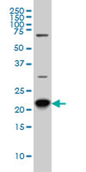 RAB8A monoclonal antibody (M02), clone 3G1