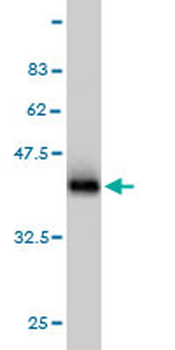 RAB8A monoclonal antibody (M02), clone 3G1