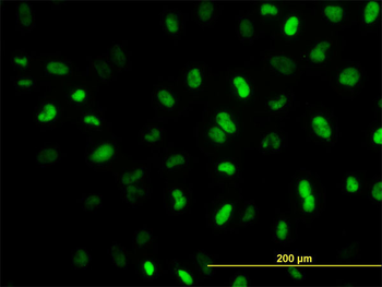 MEIS2 monoclonal antibody (M01), clone 1H4