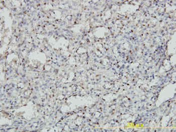 MEIS2 monoclonal antibody (M01), clone 1H4