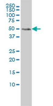 MEIS2 monoclonal antibody (M01), clone 1H4