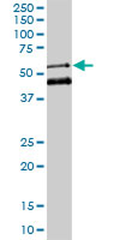MEIS2 monoclonal antibody (M01), clone 1H4