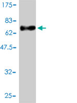 MEIS2 monoclonal antibody (M01), clone 1H4