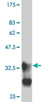 MEF2B monoclonal antibody (M24), clone 4B5