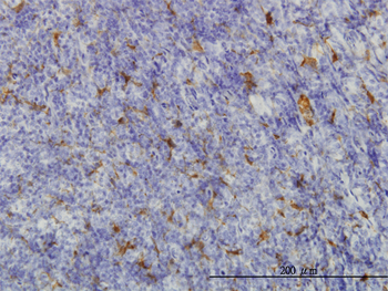 ME1 monoclonal antibody (M03), clone 3H5