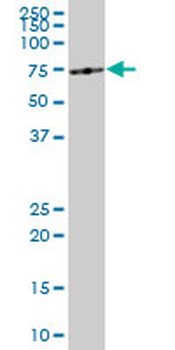 ME1 monoclonal antibody (M03), clone 3H5