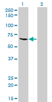 ME1 monoclonal antibody (M03), clone 3H5