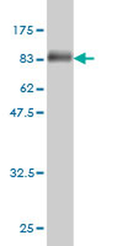 ME1 monoclonal antibody (M03), clone 3H5