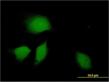 DNAJB9 monoclonal antibody (M09), clone 3G4