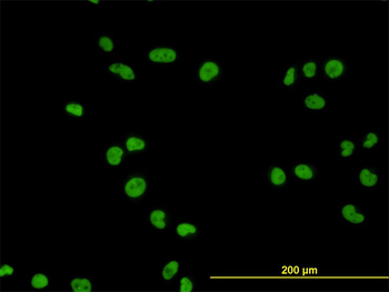 MCM7 monoclonal antibody (M01), clone 6C2