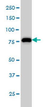 MCM7 monoclonal antibody (M01), clone 6C2